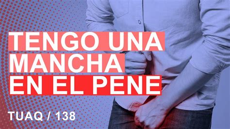 Manchas negras en el pene pueden ser cáncer